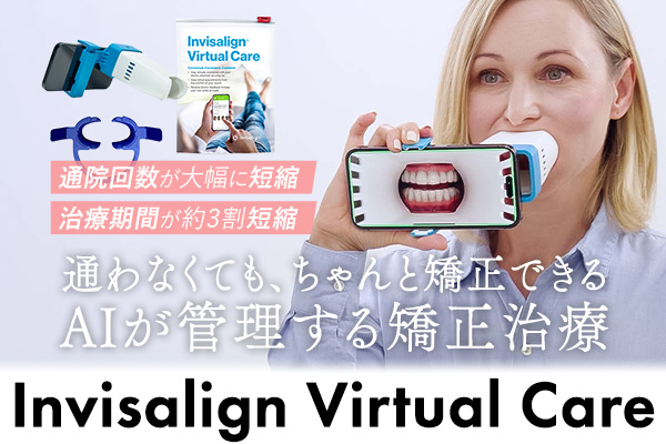 AIモニタリング