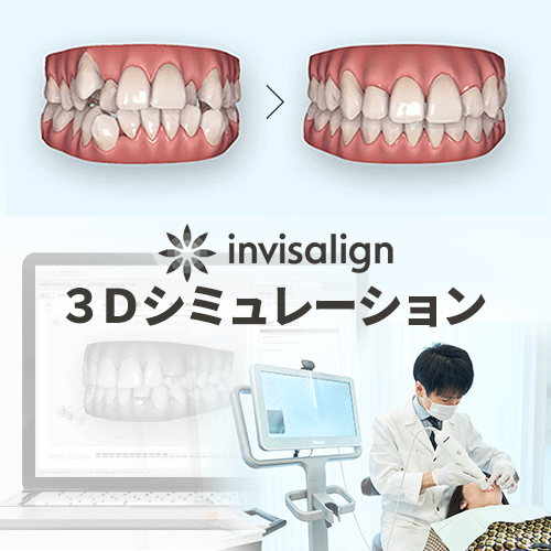3Dシミュレーション