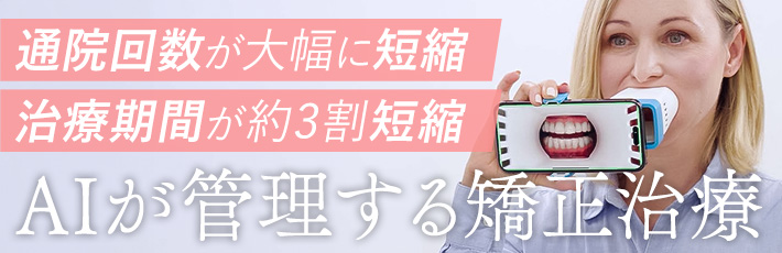 AI���j�^�����O