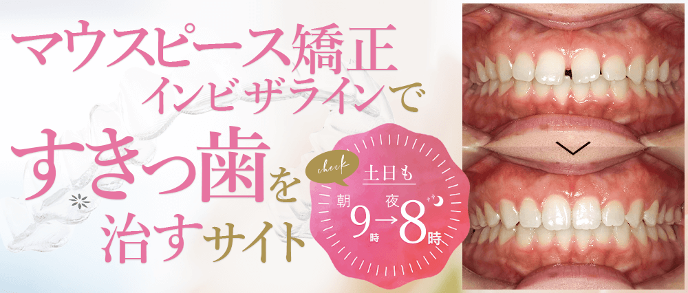 �C���r�U���C���ł��������������T�C�g