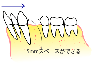 5mmXy[Xł