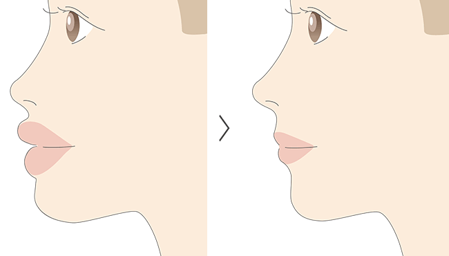 �㉺�Z�b�g�o�b�N