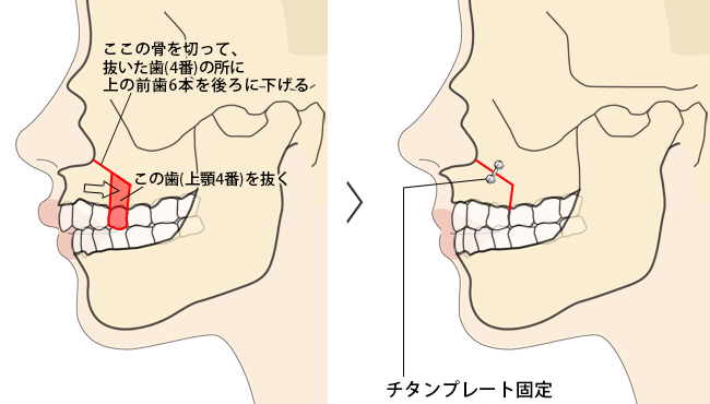 ゠ZbgobN